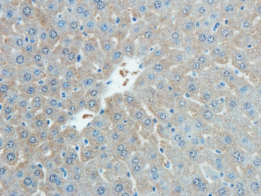 CD38 Rabbit Polyclonal Antibody