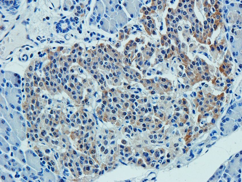 CD38 Rabbit Polyclonal Antibody