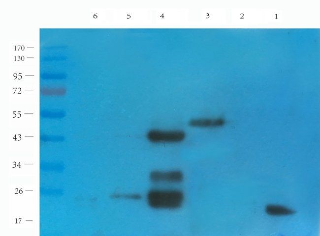 CD38 Rabbit Polyclonal Antibody