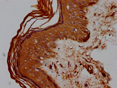 CD44 Antibody