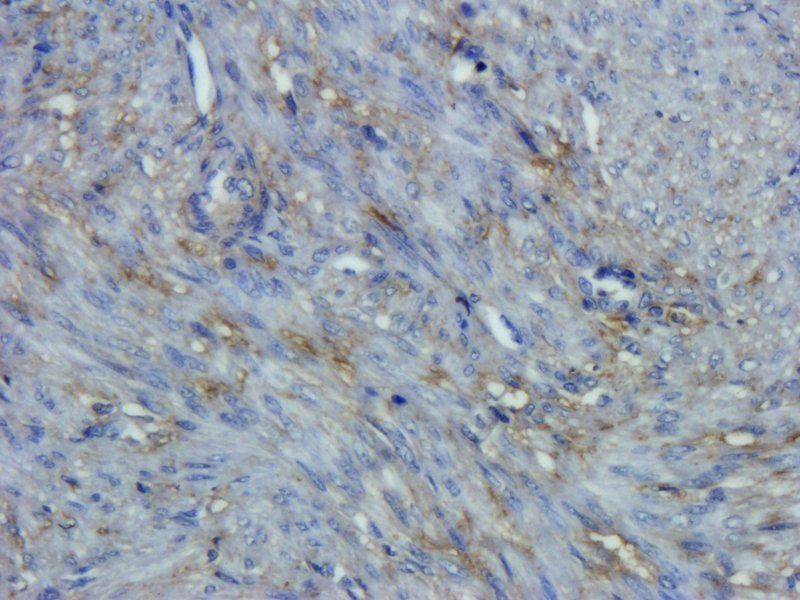 CD44 Rabbit Polyclonal Antibody