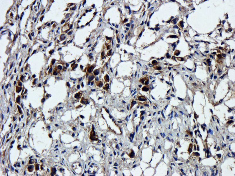 CD44 Rabbit Polyclonal Antibody