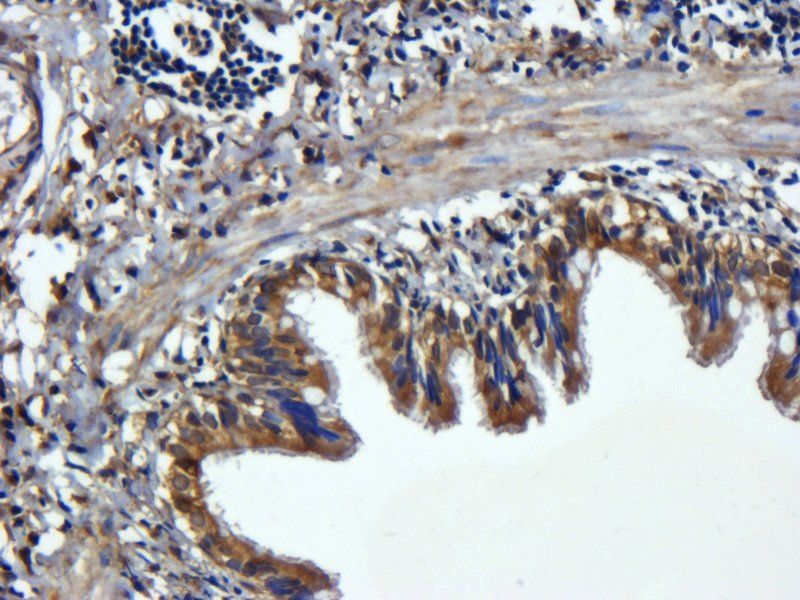 CD44 Rabbit Polyclonal Antibody