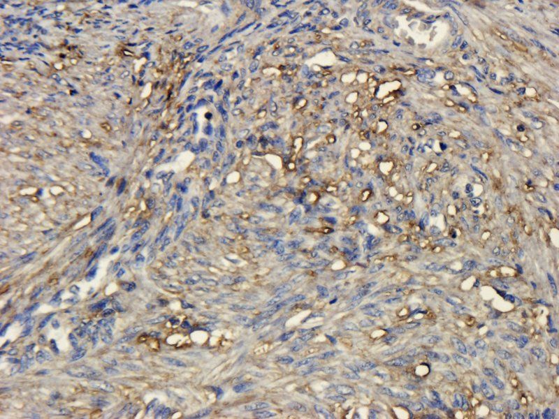 CD44 Rabbit Polyclonal Antibody