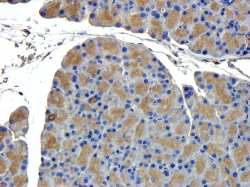 CD44 Rabbit Polyclonal Antibody