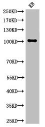 NOTCH1 Antibody