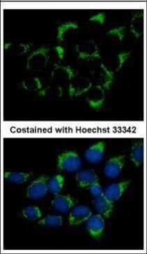 CMG1 Rabbit Polyclonal Antibody