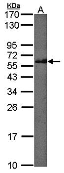 CMG1 antibody