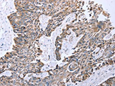 CPT1A Antibody