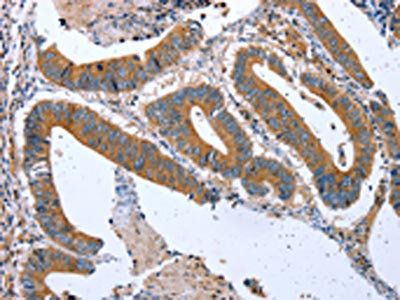 CPT1A Antibody