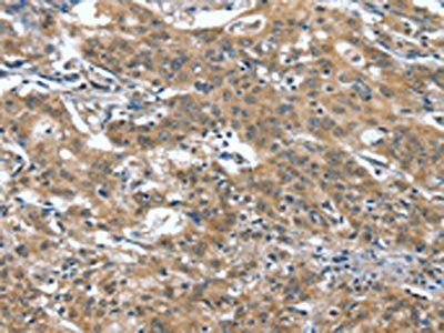 DTX1 Antibody