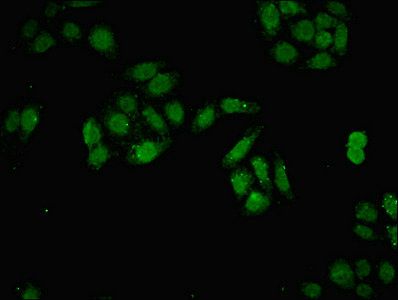 DNMT3B Antibody