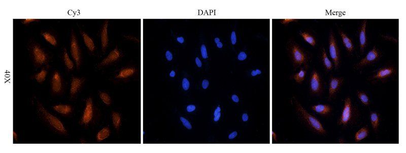 Endothelin 1 Rabbit Polyclonal Antibody