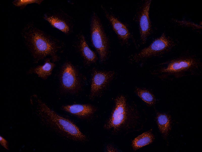 Endothelin 1 Rabbit Polyclonal Antibody