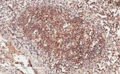 GRB2 Antibody