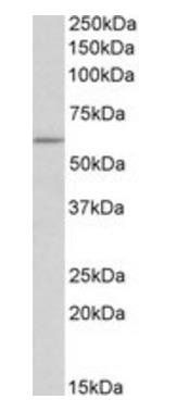 TPH2 (aa16-29) Antibody