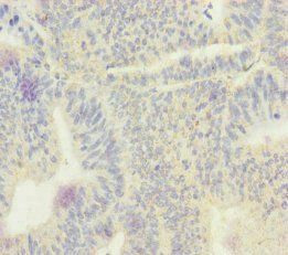 ECHS1 Antibody
