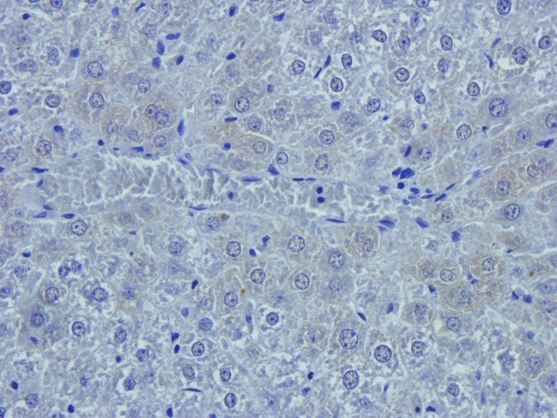 Emp1 Rabbit Polyclonal Antibody