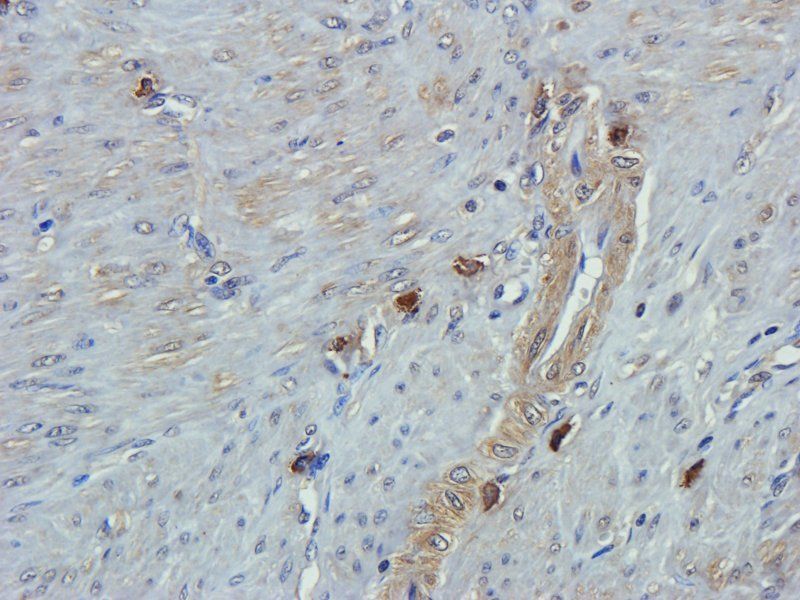 Emp1 Rabbit Polyclonal Antibody