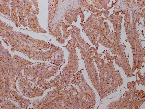 ENO1 Antibody