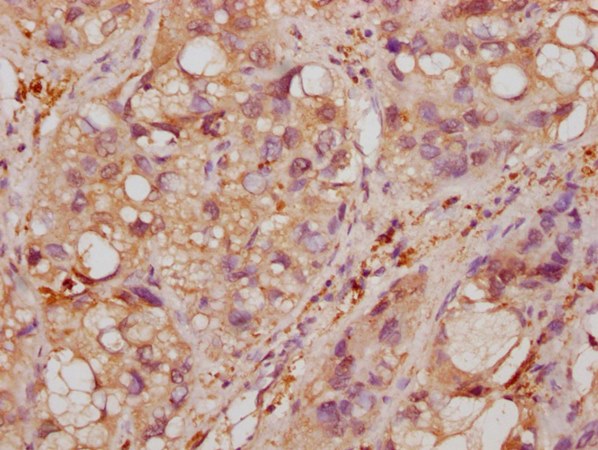 ENO1 Antibody