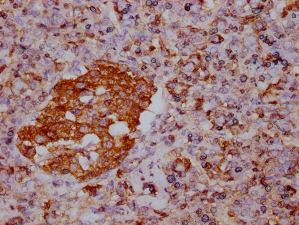 ENO1 Antibody