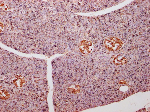 ENO1 Antibody