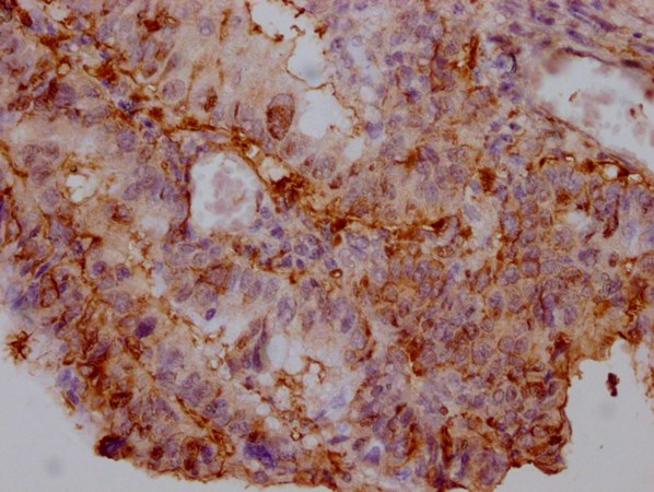 ENO1 Antibody