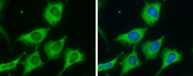 Fatty Acid Synthase Rabbit Polyclonal Antibody