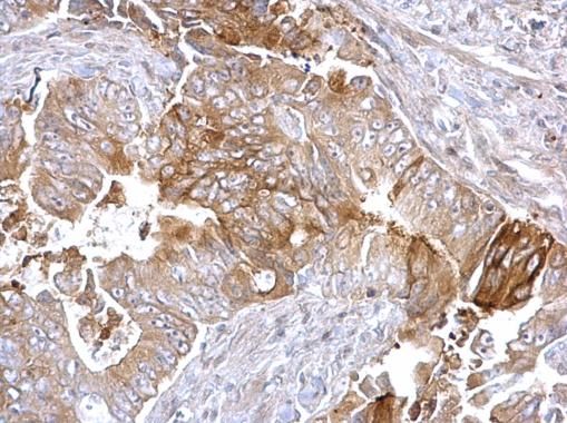 Fatty Acid Synthase Rabbit Polyclonal Antibody