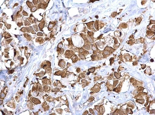 Fatty Acid Synthase Rabbit Polyclonal Antibody
