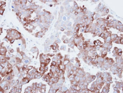 Fatty Acid Synthase Rabbit Polyclonal Antibody