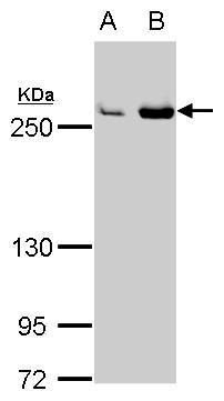 Fatty Acid Synthase Rabbit Polyclonal Antibody