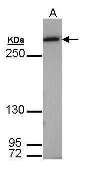 Fatty Acid Synthase Rabbit Polyclonal Antibody