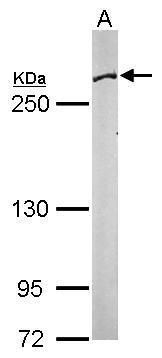 Fatty Acid Synthase Rabbit Polyclonal Antibody