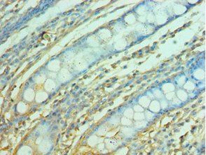 FOSL1 Antibody