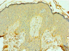 FOSL1 Antibody