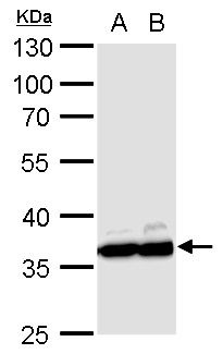 GAPDH Rabbit Polyclonal Antibody