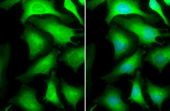GAPDH Rabbit Polyclonal Antibody