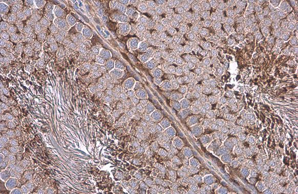 GAPDH Rabbit Polyclonal Antibody