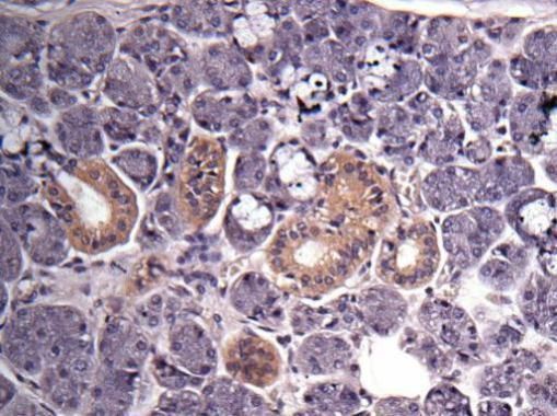 GAPDH Rabbit Polyclonal Antibody
