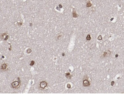 Phospho-pan-AKT1/2/3 (Ser473) Antibody