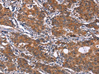 GLS Antibody