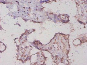 PYGL Antibody