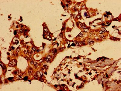 GRIN2A Antibody