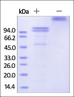 Human E-Cadherin Protein, Fc Tag