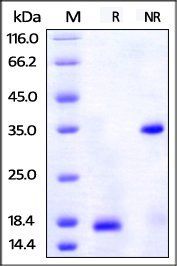 Human PDGF-BB Protein, His-Avi Tag