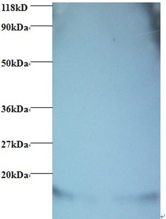 Hemoglobin Antibody (FITC)