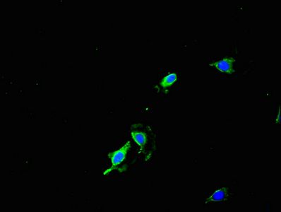 RIDA Antibody