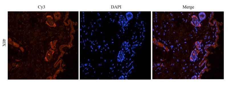IL6 Rabbit Polyclonal Antibody